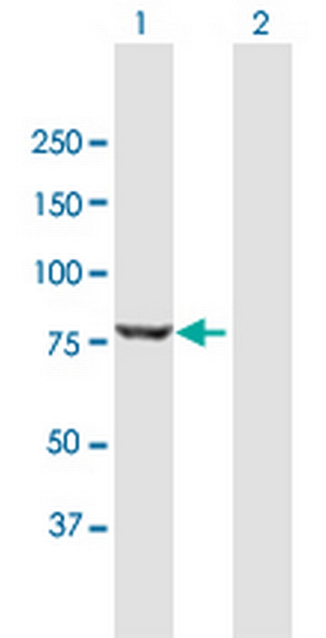 DKFZP434G1415 Antibody in Western Blot (WB)