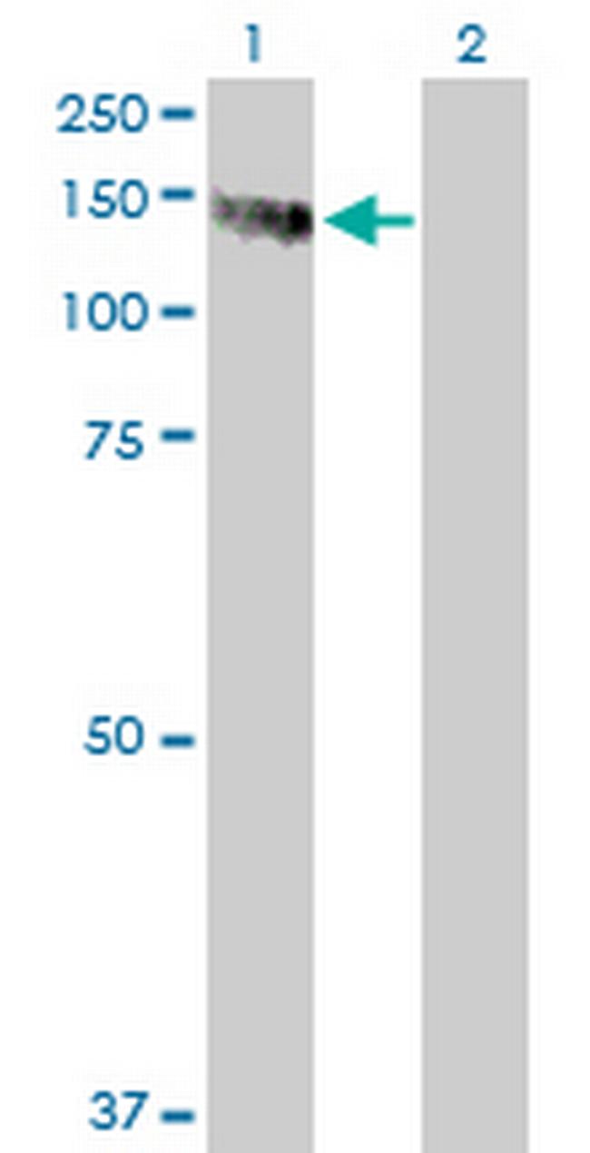 PMFBP1 Antibody in Western Blot (WB)