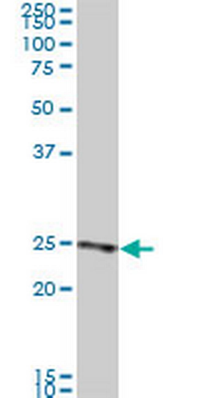 RAB33B Antibody in Western Blot (WB)