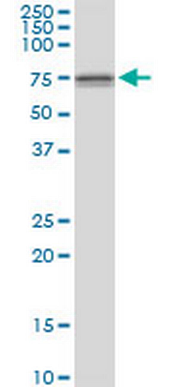 DDX59 Antibody in Western Blot (WB)