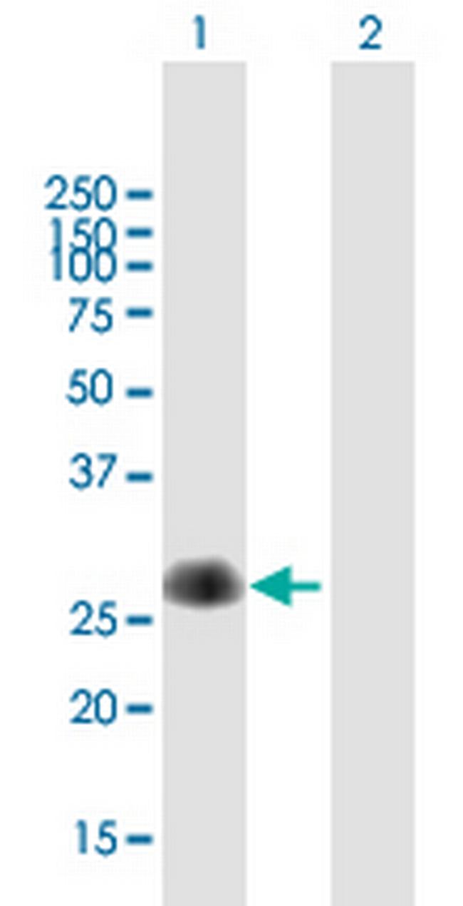 C7orf21 Antibody in Western Blot (WB)