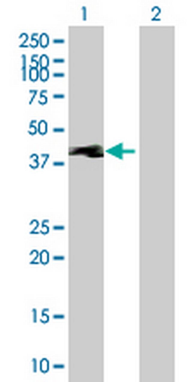 TEKT1 Antibody in Western Blot (WB)