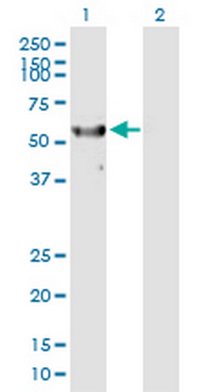 RPS6KL1 Antibody in Western Blot (WB)