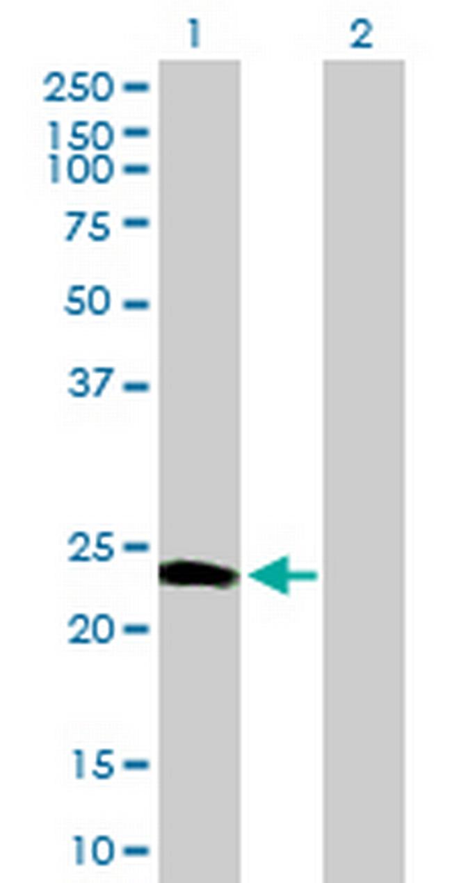 CALN1 Antibody in Western Blot (WB)
