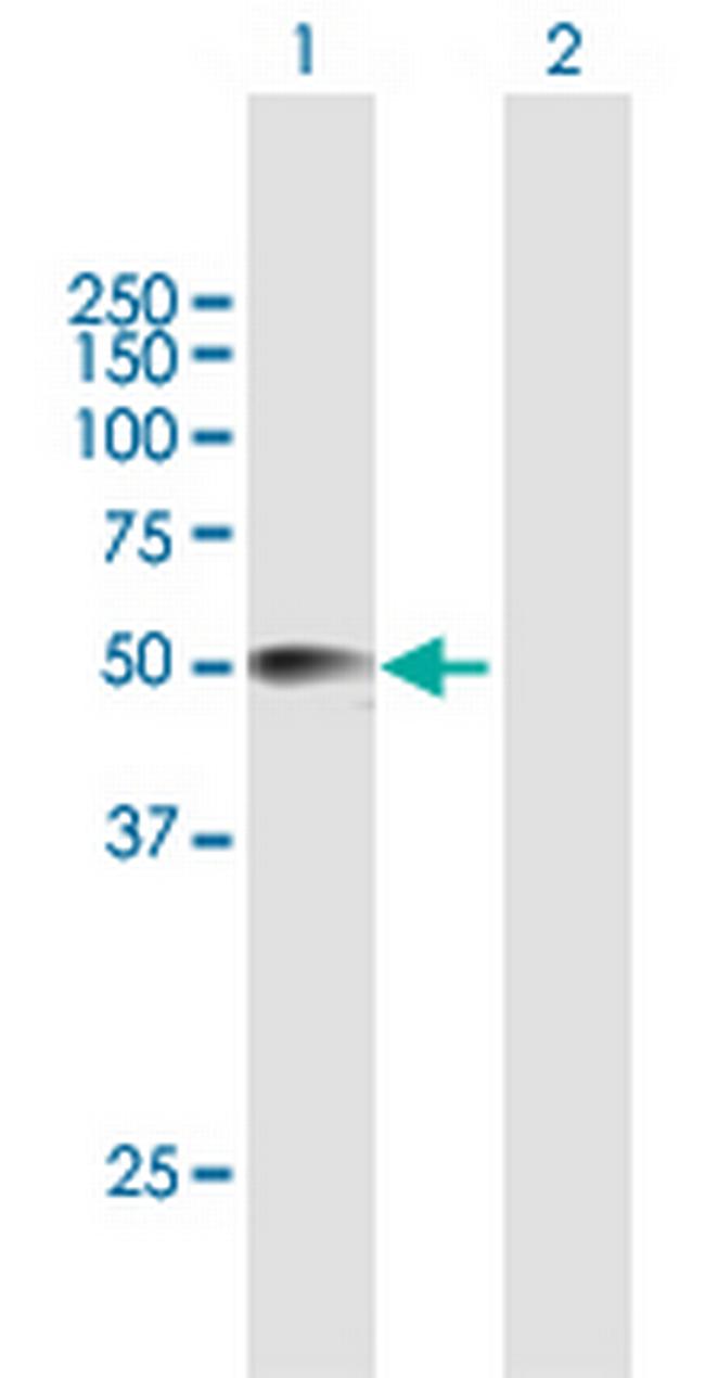 CRISPLD2 Antibody in Western Blot (WB)