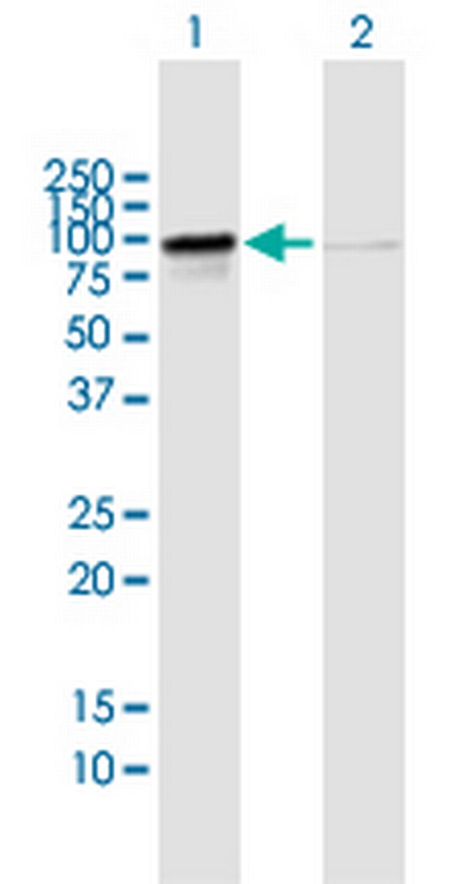 RIOK1 Antibody in Western Blot (WB)