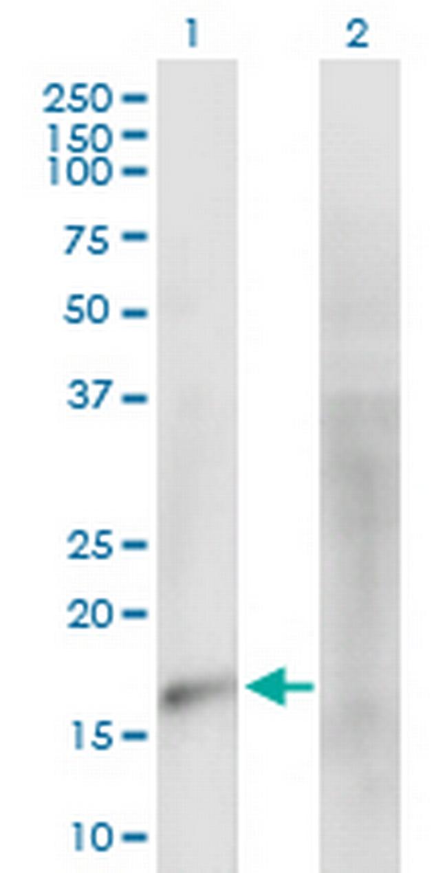 MARVELD1 Antibody in Western Blot (WB)