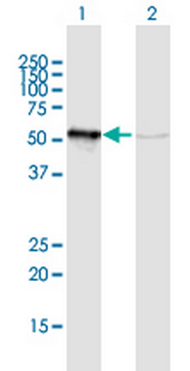 GRWD1 Antibody in Western Blot (WB)
