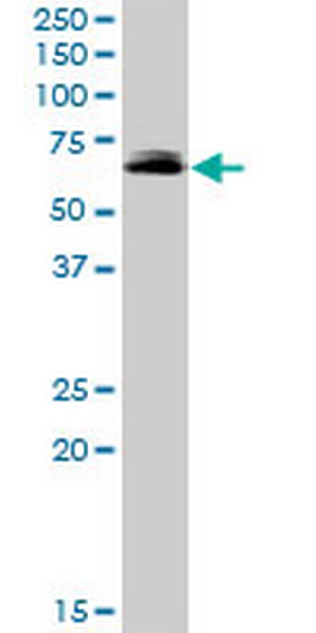FRMD8 Antibody in Western Blot (WB)