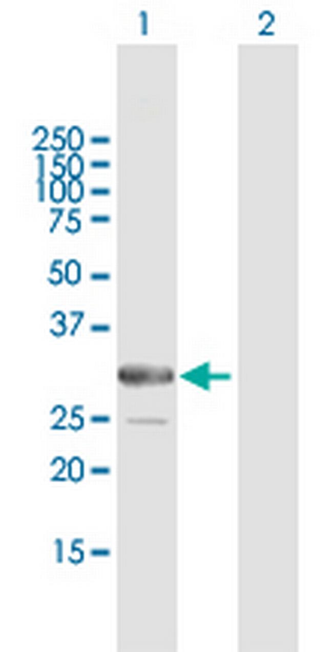 ARMC10 Antibody in Western Blot (WB)