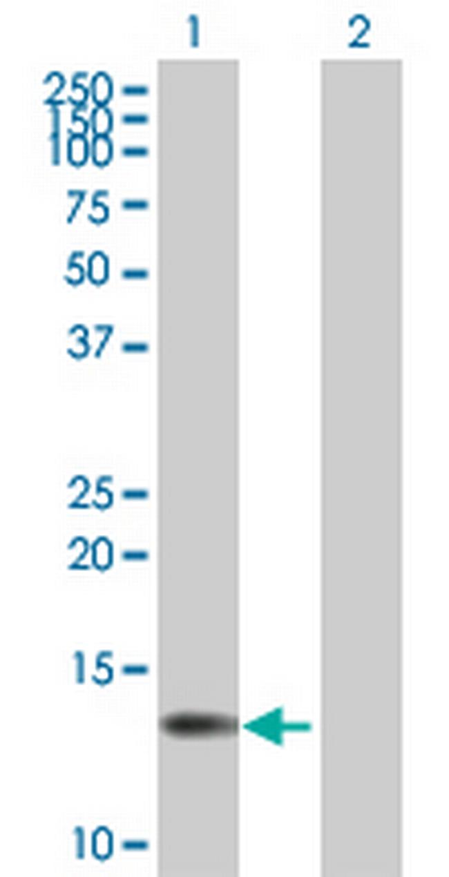 FSD1NL Antibody in Western Blot (WB)