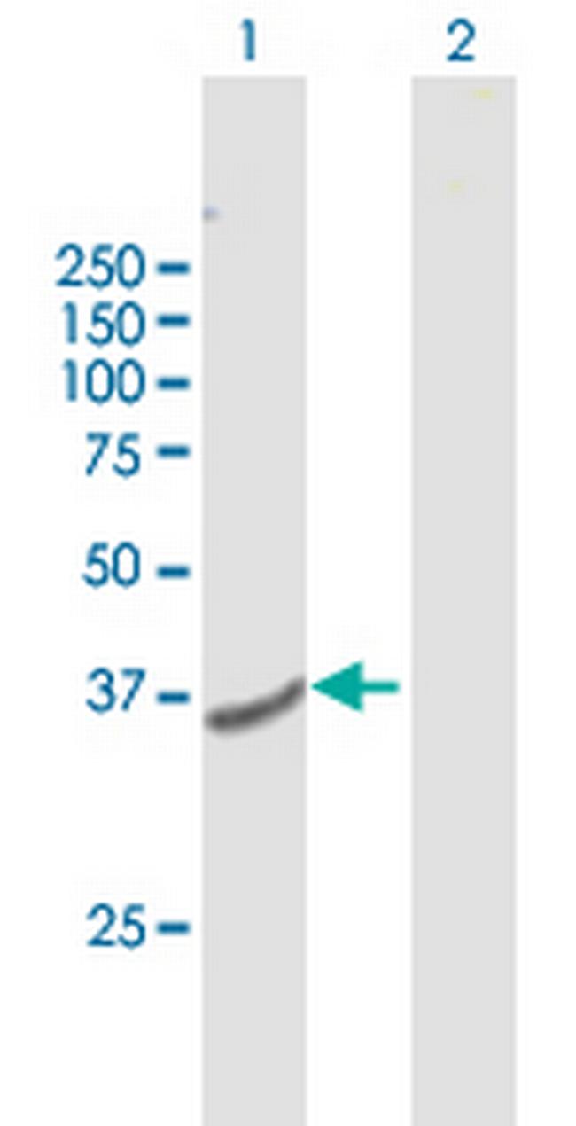TMEM120A Antibody in Western Blot (WB)