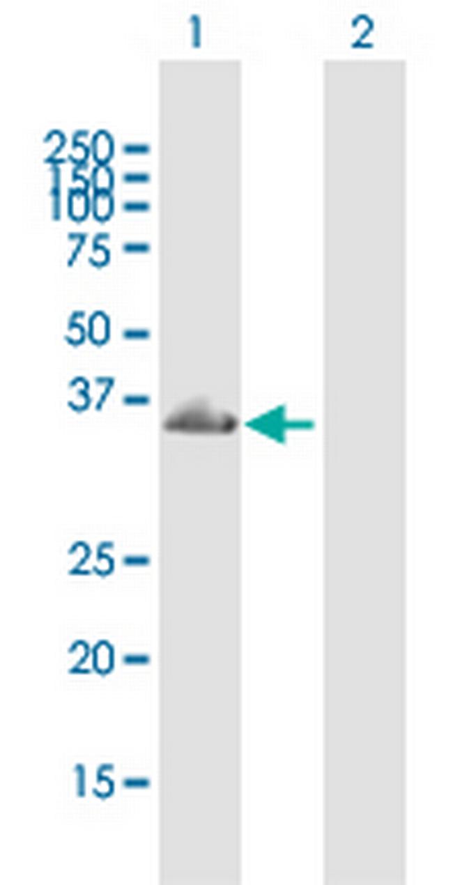 TBC1D10A Antibody in Western Blot (WB)