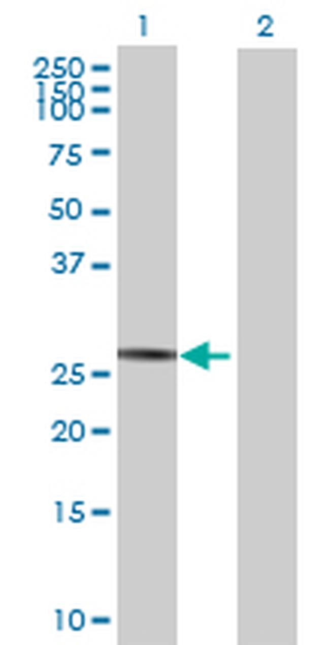 SPATA9 Antibody in Western Blot (WB)