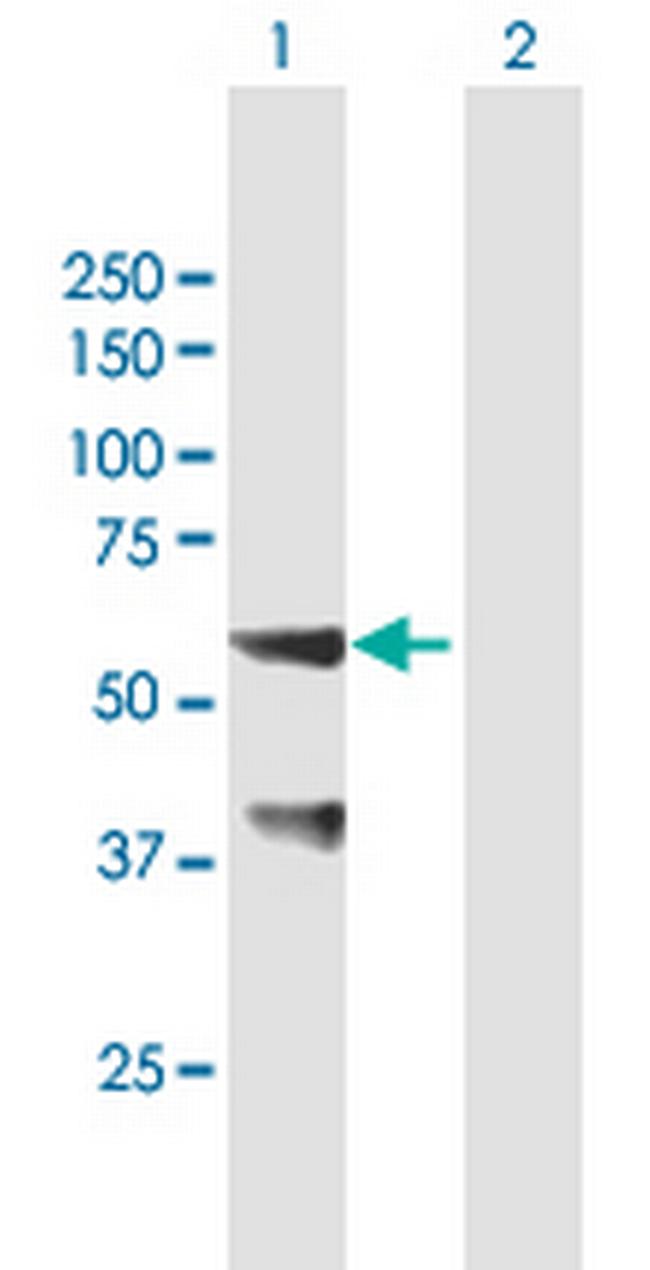 SNX25 Antibody in Western Blot (WB)