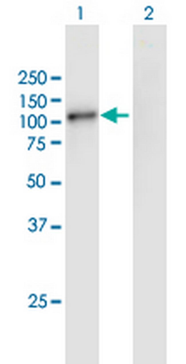 GSG2 Antibody in Western Blot (WB)