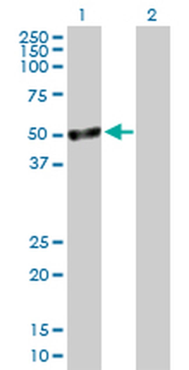 TSSK1B Antibody in Western Blot (WB)
