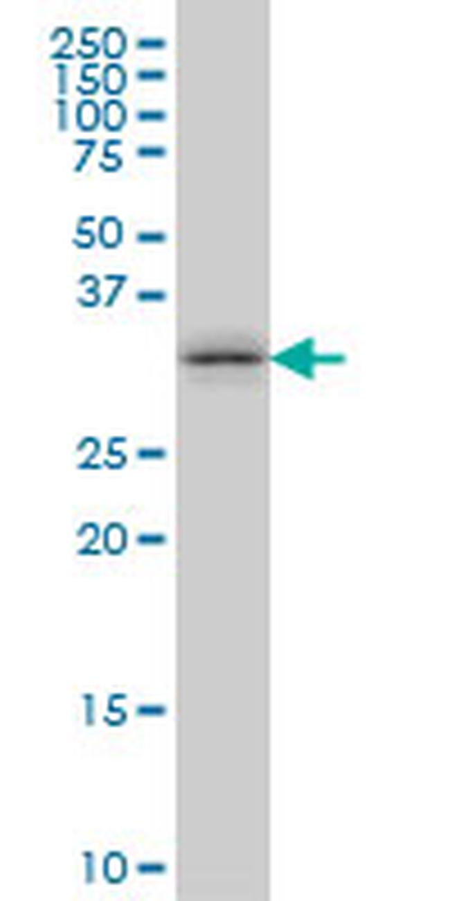 TSSK6 Antibody in Western Blot (WB)