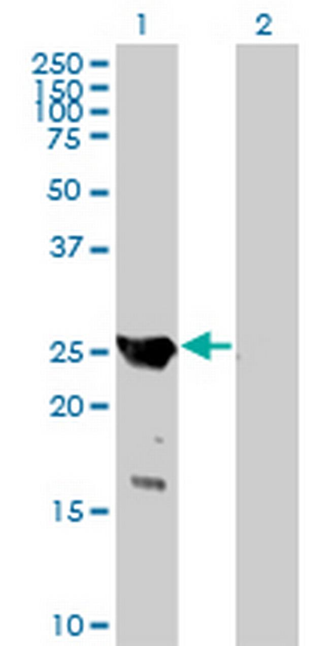 GAJ Antibody in Western Blot (WB)