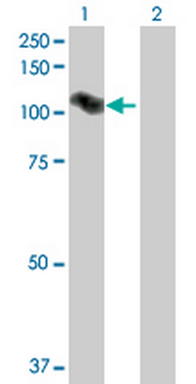 ARMC2 Antibody in Western Blot (WB)
