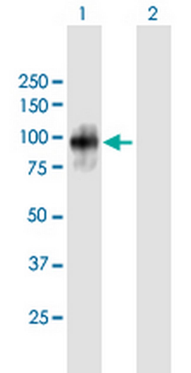 FBXO30 Antibody in Western Blot (WB)