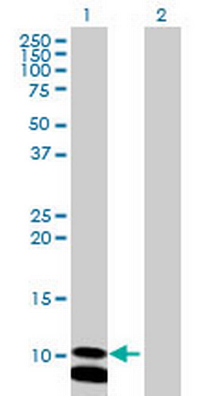 PCBD2 Antibody in Western Blot (WB)