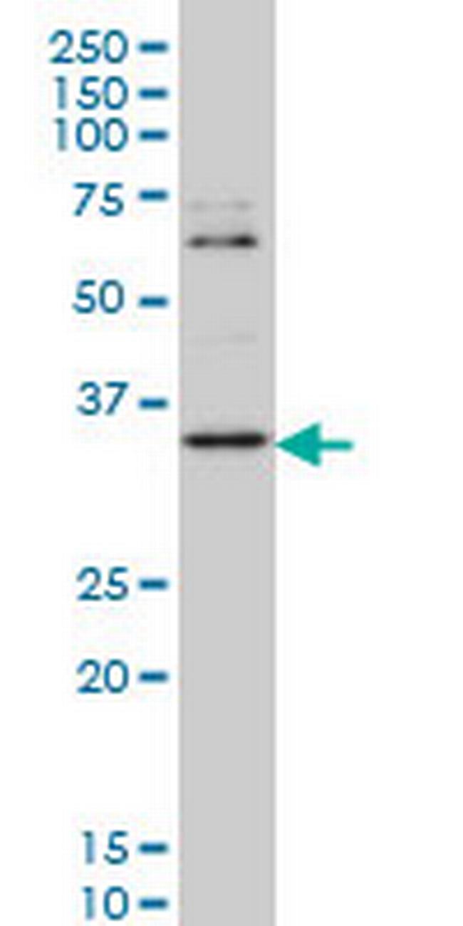 ZIC4 Antibody in Western Blot (WB)