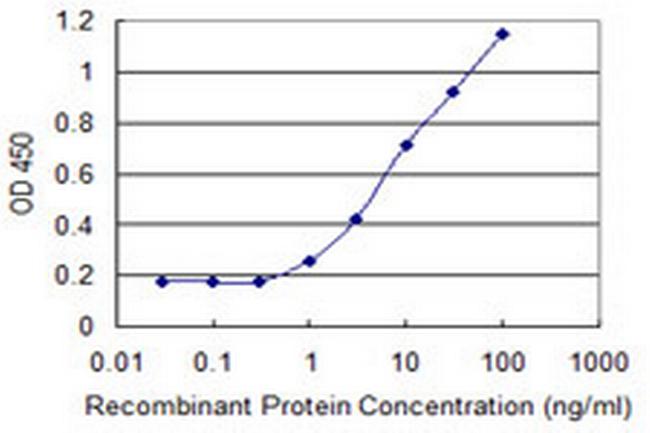 ARID5B Antibody in ELISA (ELISA)