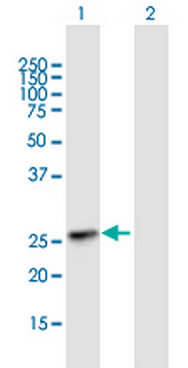 KIAA1109 Antibody in Western Blot (WB)