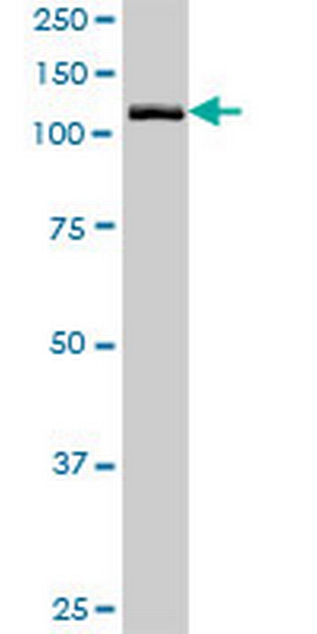 GTF2IRD2 Antibody in Western Blot (WB)