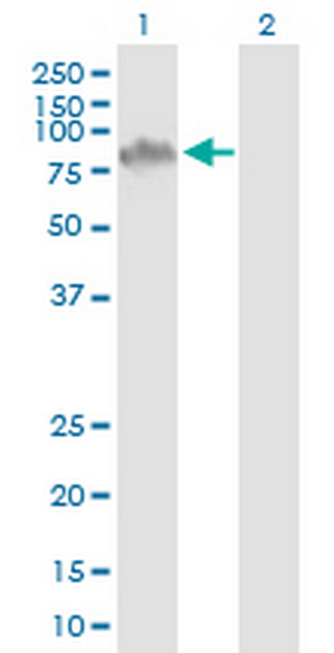 ZCCHC7 Antibody in Western Blot (WB)