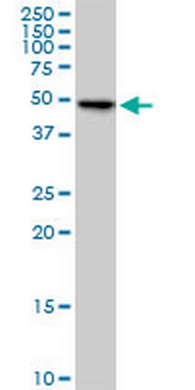 FLJ23356 Antibody in Western Blot (WB)
