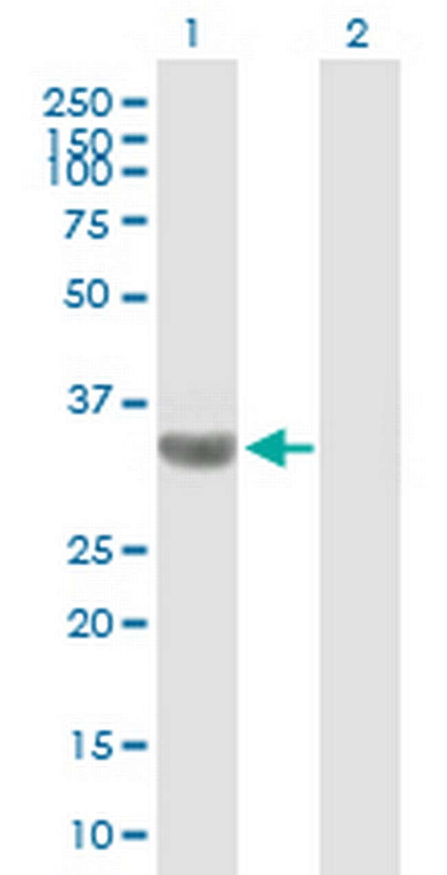 TBC1D3 Antibody in Western Blot (WB)