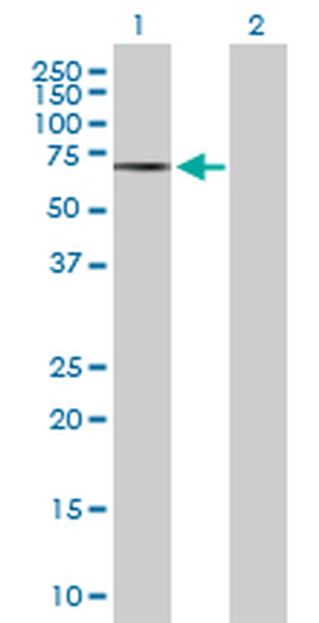 CAMKK1 Antibody in Western Blot (WB)