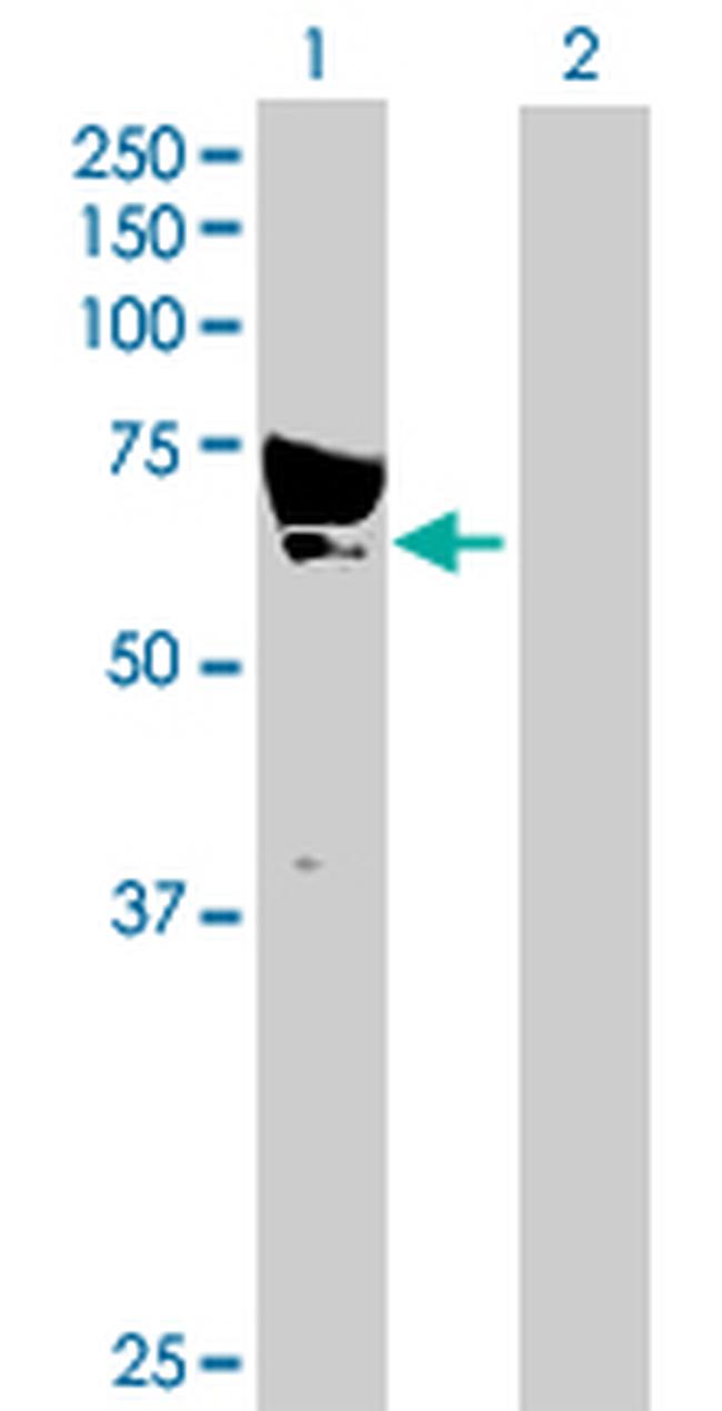 CAMKK1 Antibody in Western Blot (WB)