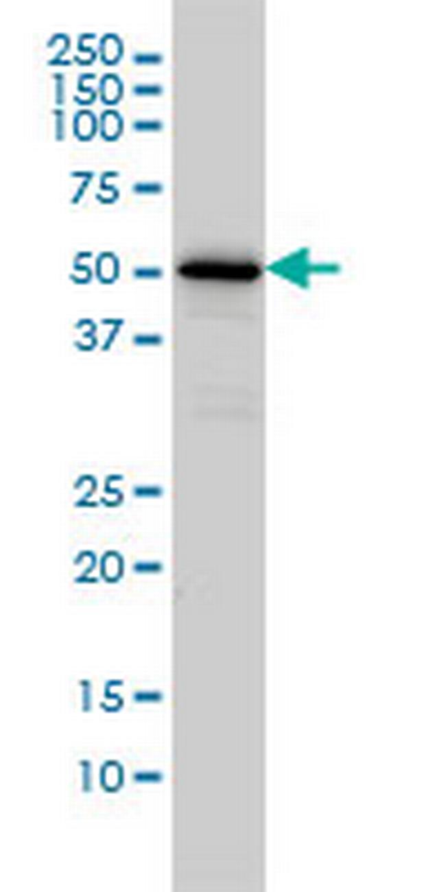 CAMKK1 Antibody in Western Blot (WB)