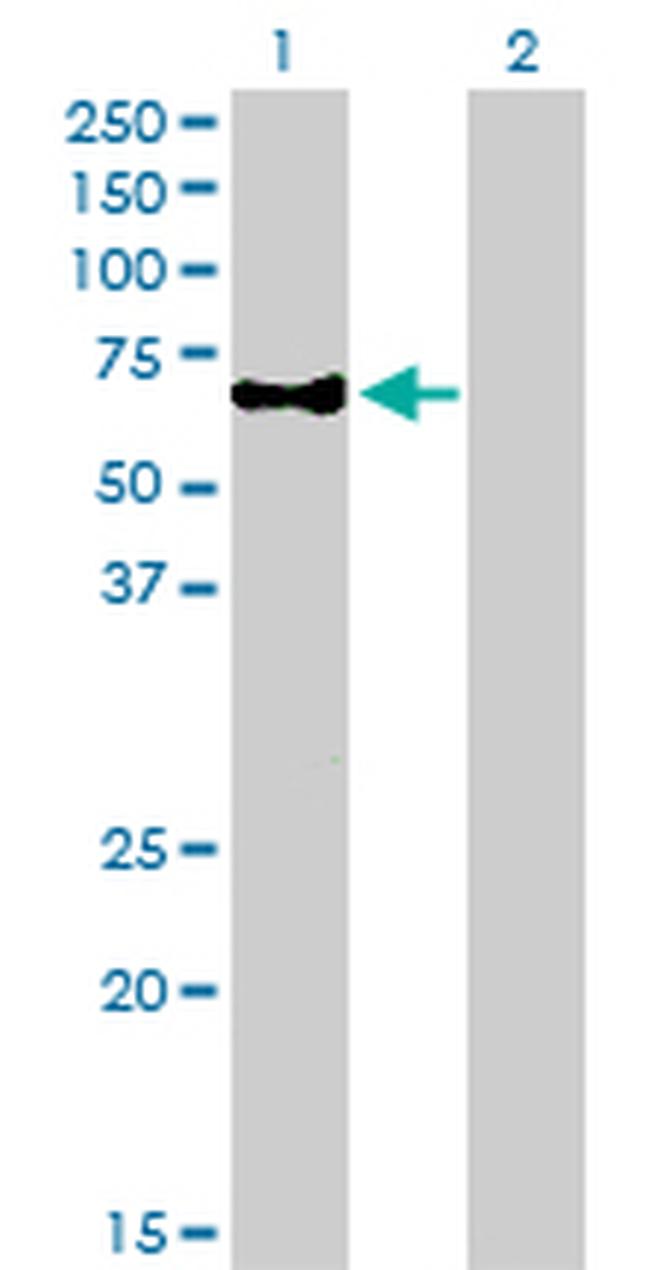 CAMKK1 Antibody in Western Blot (WB)