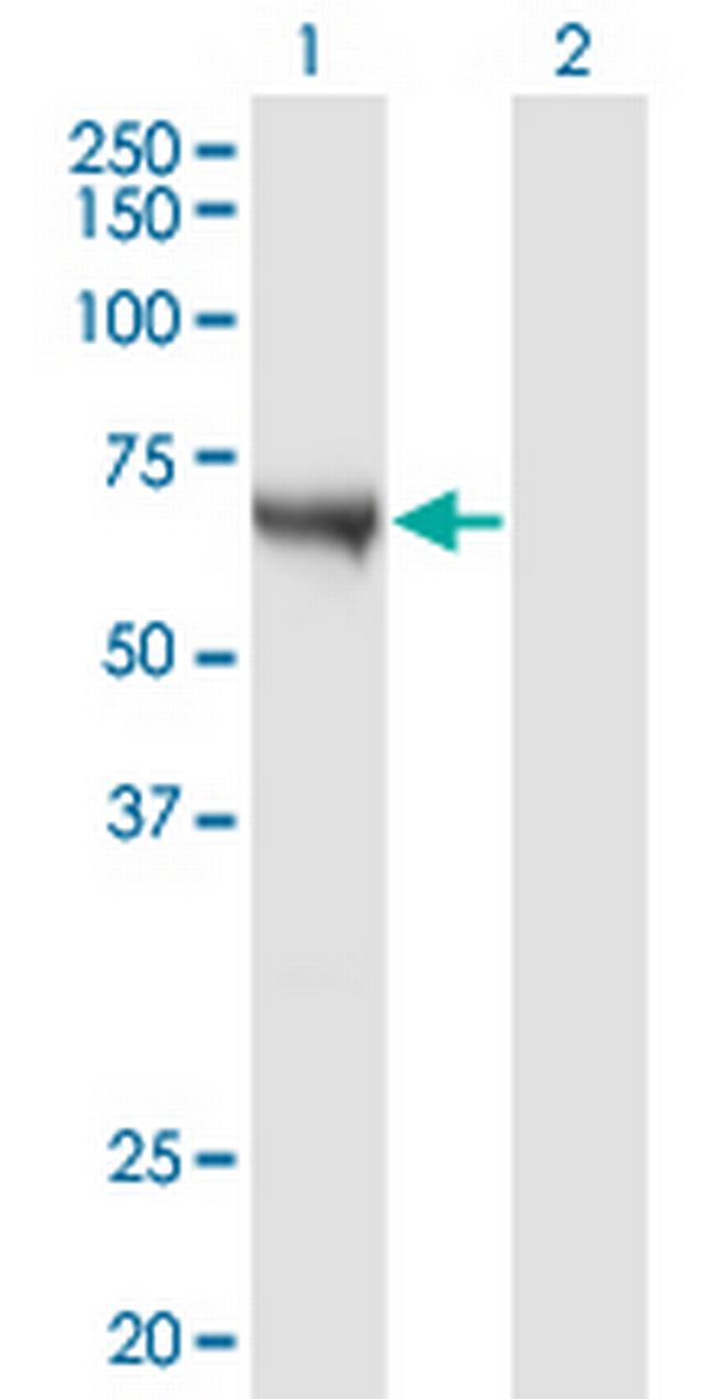 CAMKK1 Antibody in Western Blot (WB)