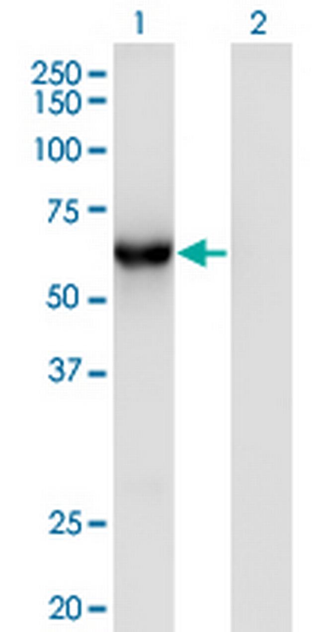 CAMKK1 Antibody in Western Blot (WB)