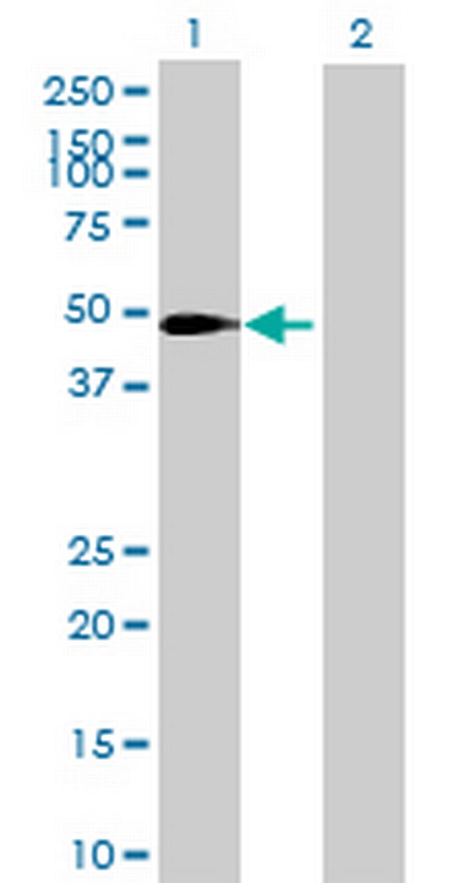 SLC37A3 Antibody in Western Blot (WB)
