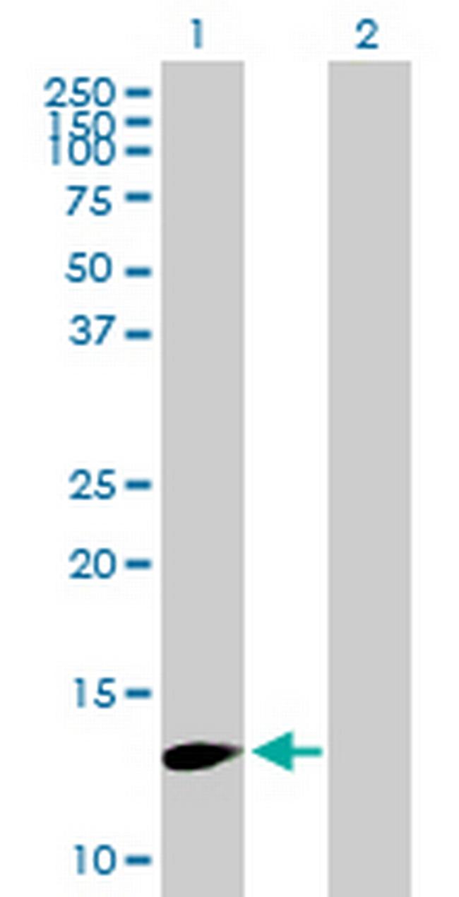 FBXW9 Antibody in Western Blot (WB)