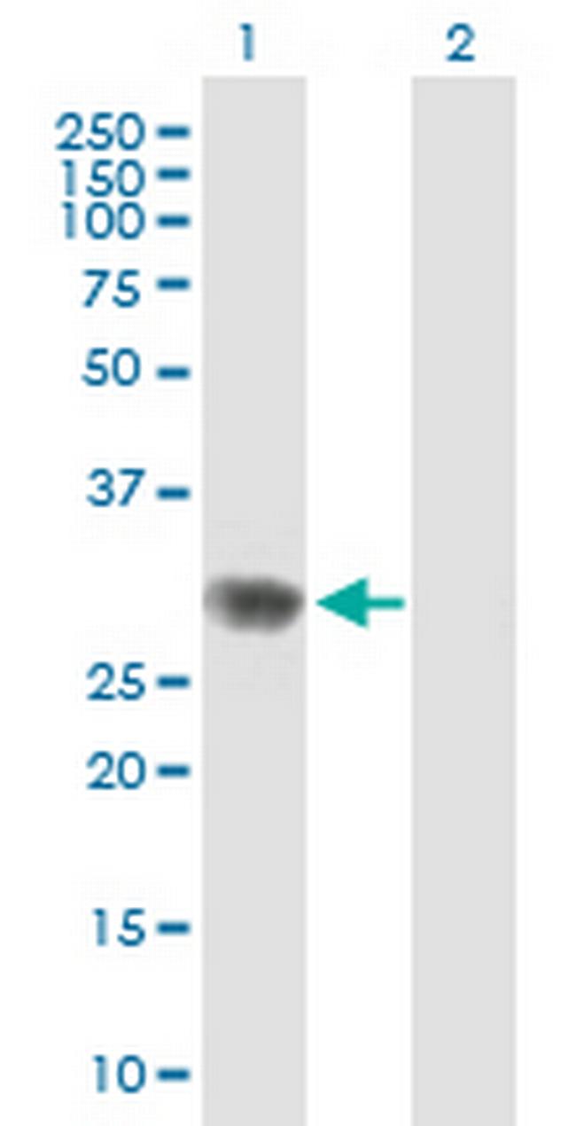 RPAIN Antibody in Western Blot (WB)