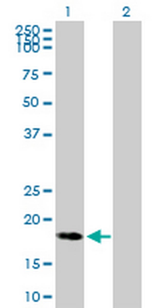 C9orf89 Antibody in Western Blot (WB)