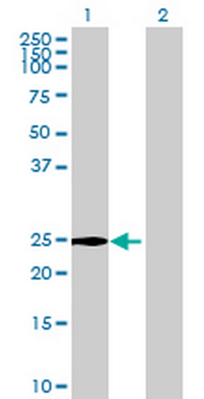 C2orf7 Antibody in Western Blot (WB)