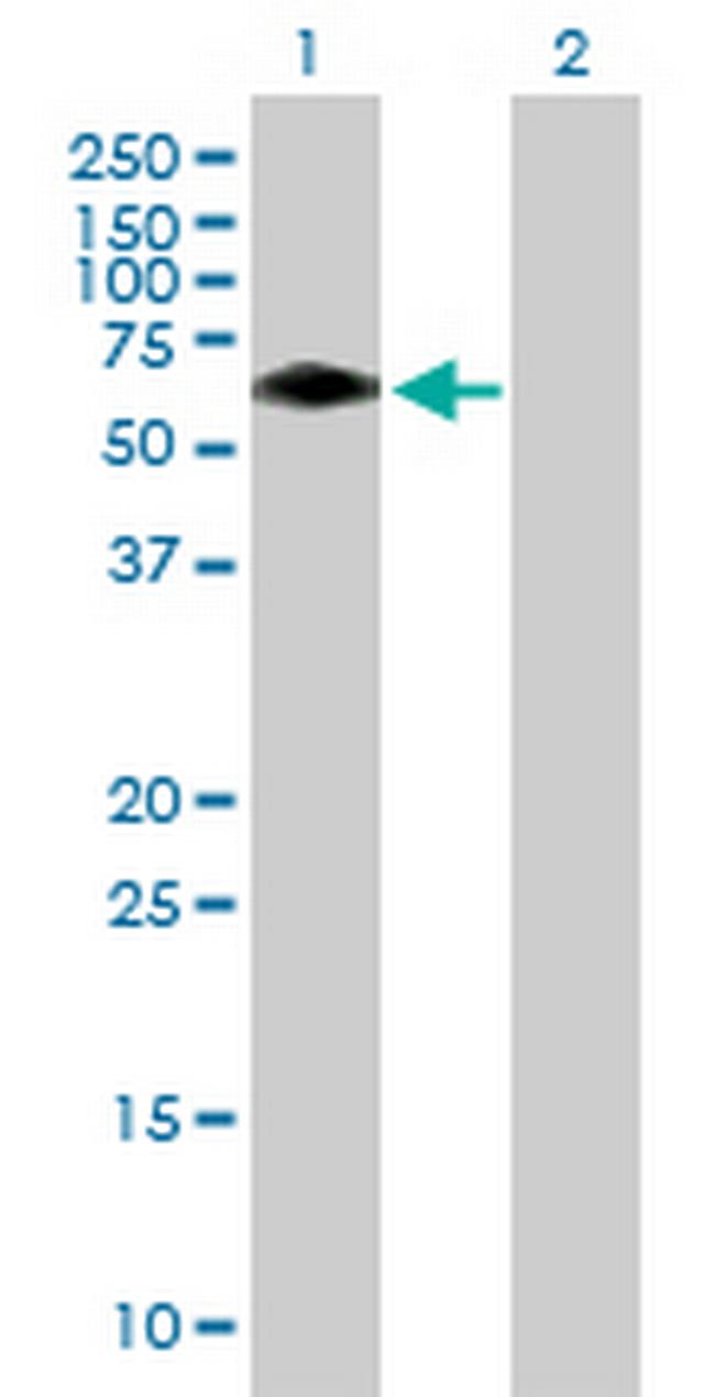 BTBD10 Antibody in Western Blot (WB)