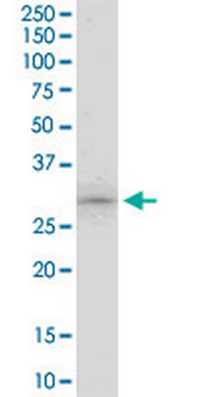 ING5 Antibody in Western Blot (WB)