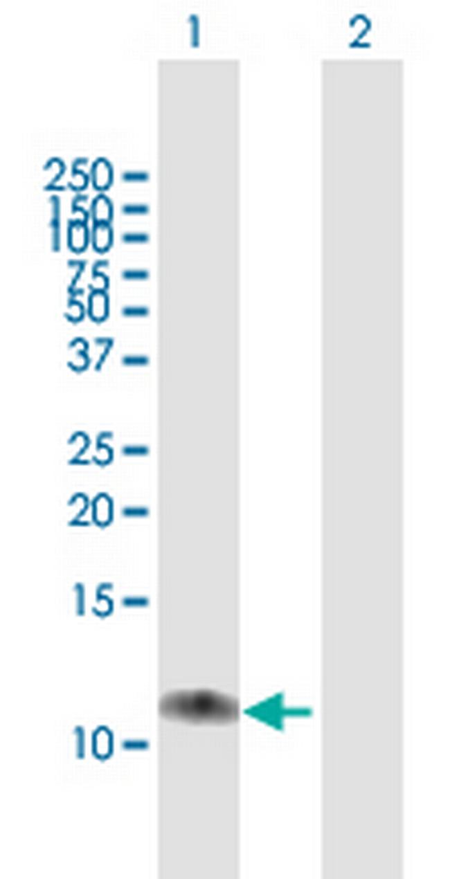 C17orf37 Antibody in Western Blot (WB)