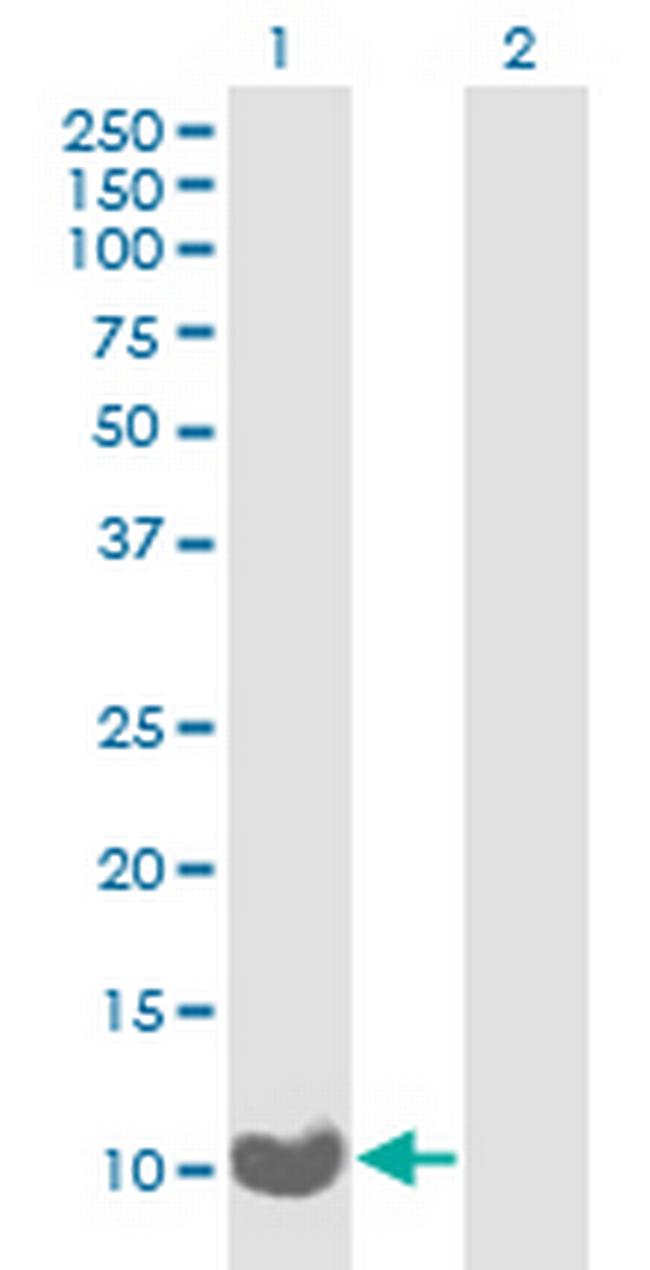C17orf37 Antibody in Western Blot (WB)