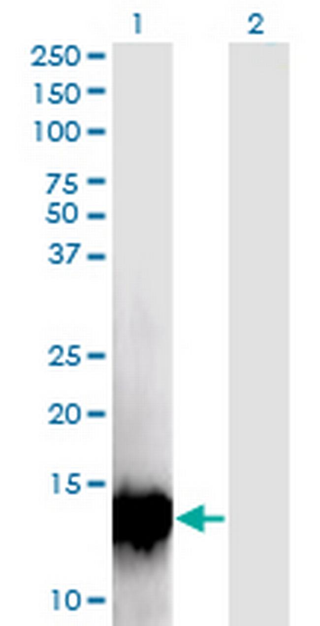 C17orf37 Antibody in Western Blot (WB)