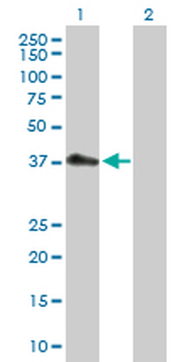 PDCD2L Antibody in Western Blot (WB)